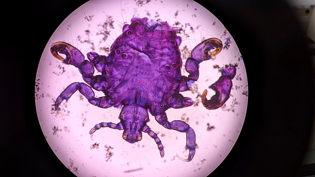 Descubra as principais diferenças entre vermífugos e antiparasitários de pulgas, como atuam, quando usar e dicas…