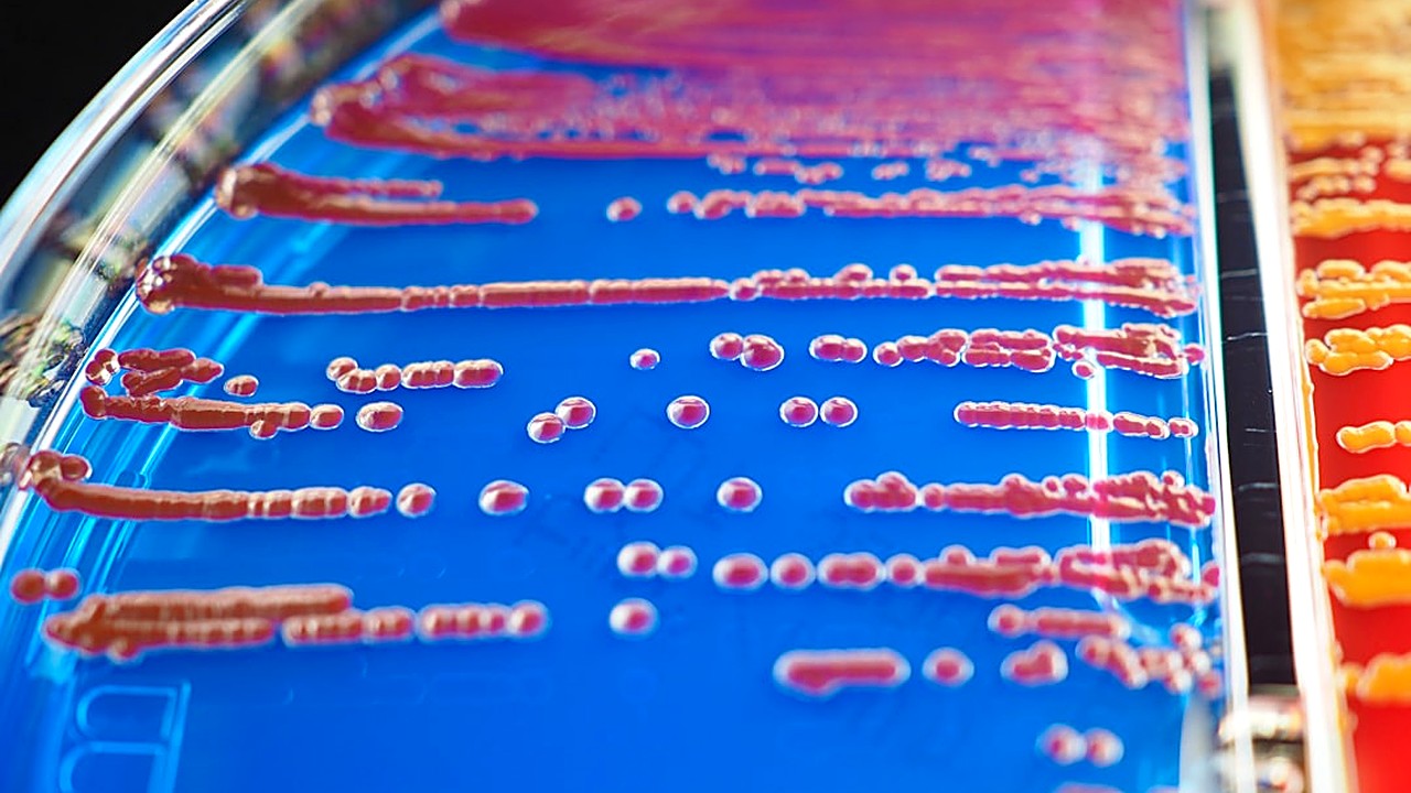 Descubre cómo el ayuno intermitente modula tu microbiota intestinal, mejora la salud digestiva y fortalece el sistema…