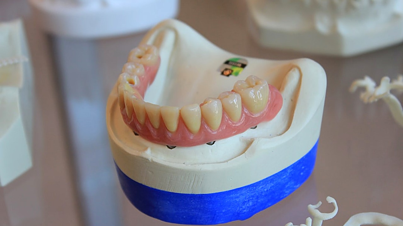 Learn gentle ways to care for bleeding gums if you take blood thinners. Safe tips for daily oral health without risk.